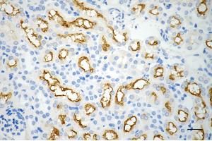 Immunohistochemistry was performed on paraffin-embedded mouse kidney using ABCB1 antibody (ABIN7797683), 1:200).