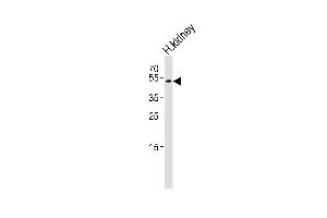 Western blot analysis of lysate from hun kidney tissue lysate, using PSL Antibody (Center) (ABIN651259 and ABIN2840158). (FOLH1B antibody  (AA 155-183))