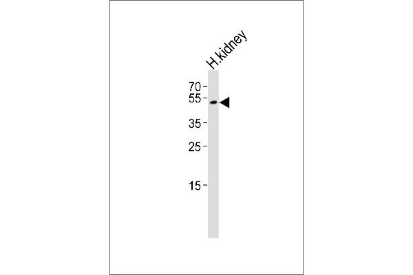 FOLH1B anticorps  (AA 155-183)