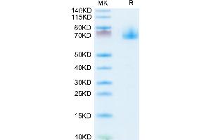SDS-PAGE (SDS) image for EPH Receptor A10 (EPHA10) (AA 23-565) protein (His tag) (ABIN7274562)
