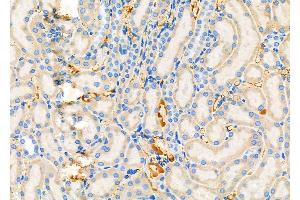 ABIN6264924 and ABIN6279466 at 1/100 staining Rat kidney tissue by IHC-P. (SAR1A antibody  (Internal Region))