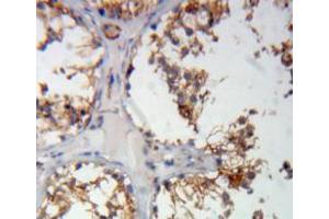 Used in DAB staining on fromalin fixed paraffin-embedded testis tissue (COMP antibody  (AA 123-240))