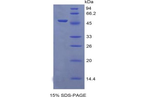 EGFR2 Protein