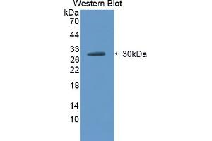 Western Blotting (WB) image for anti-Sodium Channel, Nonvoltage-Gated 1, gamma (SCNN1G) (AA 1-182) antibody (ABIN1870655)
