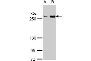 Western Blotting (WB) image for anti-Fatty Acid Synthase (FASN) (N-Term) antibody (ABIN2856708)