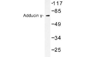 Image no. 1 for anti-Adducin 3 (Gamma) (ADD3) antibody (ABIN272287) (ADD3 antibody)