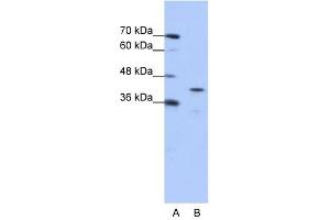 CPEB2 antibody used at 0. (CPEB2 antibody  (Middle Region))
