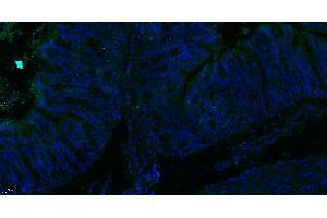 Paraformaldehyde-fixed, paraffin embedded Rat colon; Antigen retrieval by boiling in sodium citrate buffer (pH6. (MTM1 antibody  (AA 225-275))
