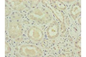 Immunohistochemistry of paraffin-embedded human kidney tissue using ABIN7175282 at dilution of 1:100 (VPS11 antibody  (AA 692-941))