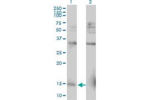 Western Blot analysis of RPL30 expression in transfected 293T cell line by RPL30 monoclonal antibody (M04), clone 2F6. (RPL30 antibody  (AA 1-115))