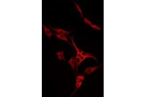 ABIN6274977 staining LOVO by IF/ICC. (SLC7A4 antibody  (C-Term))