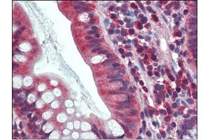 Human Small Intestine: Formalin-Fixed, Paraffin-Embedded (FFPE) (CA1 antibody  (Internal Region))