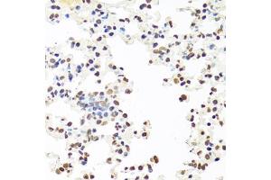 Immunohistochemistry of paraffin-embedded mouse lung using SFPQ antibody (ABIN5970351) at dilution of 1/100 (40x lens). (SFPQ antibody)
