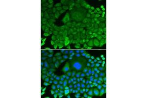 Immunofluorescence analysis of HeLa cells using RhoGDI antibody (ABIN3021743, ABIN3021744, ABIN3021745 and ABIN1512595). (ARHGDIA antibody  (AA 1-204))