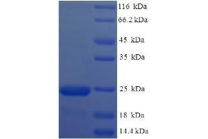 SDS-PAGE (SDS) image for OV16 (AA 17-197) protein (His tag) (ABIN5710942) (OV16 (AA 17-197) protein (His tag))