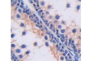 IHC-P analysis of Human Tissue, with DAB staining. (SLC2A14 antibody  (AA 230-293))