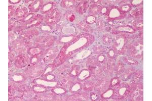 IHC using  ABCB1 Antibody at 20 ug/ml against FFPE human kidney. (ABCB1 antibody  (Internal Region))