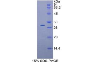 SDS-PAGE analysis of Rat TTK Protein Kinase Protein.
