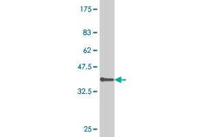 Western Blot detection against Immunogen (36. (Nucleostemin antibody  (AA 328-427))