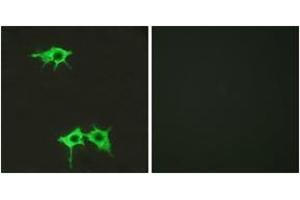 Immunofluorescence analysis of LOVO cells, using FZD4 Antibody. (FZD4 antibody  (AA 131-180))