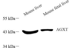 AGXT antibody