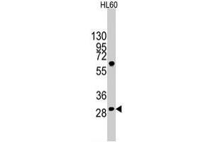 Western blot analysis of LIN28B polyclonal antibody  in HL-60 cell line lysates (35 ug/lane). (LIN28B antibody  (N-Term))