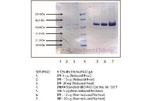 Gel Scan of Bacterial/Permeability-Increasing Protein, Human Neutrophil  (BPI, CAP57)  This information is representative of the product ART prepares, but is not lot specific.