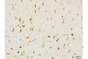 Immunohistochemistry (Paraffin-embedded Sections) (IHC (p)) image for anti-2',3'-Cyclic Nucleotide 3' phosphodiesterase (CNP) (AA 151-250) antibody (ABIN730738)