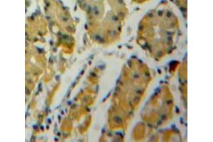 Used in DAB staining on fromalin fixed paraffin-embedded Stomach tissue (ENO1 antibody  (AA 1-434))