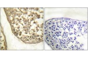 Immunohistochemistry analysis of paraffin-embedded human testis, using c-Jun (Phospho-Thr231) Antibody. (C-JUN antibody  (pThr231))