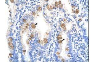 Image no. 1 for anti-TEA Domain Family Member 3 (TEAD3) (C-Term) antibody (ABIN6736262) (TEAD3 antibody  (C-Term))