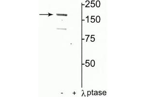 Western blot of rat hippocampal lysate showing specific immunolabeling of the ~180 kDa NR2A subunit of the NMDAR phosphorylated at Tyr1325 in the first lane (-). (NMDAR2A antibody  (pTyr1325))
