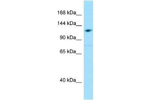 WB Suggested Anti-GRID2IP Antibody Titration: 1. (GRID2IP antibody  (Middle Region))