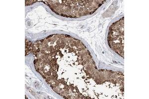 Immunohistochemical staining of human testis with KAAG1 polyclonal antibody  shows strong positivity in a subset of cells in seminiferus ducts at 1:50-1:200 dilution. (KAAG1 antibody)