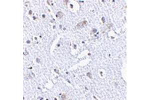 Immunohistochemistry of TIGAR in human brain tissue with TIGAAP30878PU-N at 2. (TIGAR antibody  (Center))