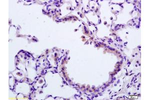 Formalin-fixed and paraffin embedded rat lung labeled with Rabbit Anti APAF1(NT) Polyclonal Antibody, Unconjugated (ABIN724310) at 1:200 followed by conjugation to the secondary antibody and DAB staining (APAF1 antibody  (AA 13-80))
