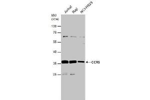 WB Image Various whole cell extracts (30 μg) were separated by 10% SDS-PAGE, and the membrane was blotted with CCR5 antibody , diluted at 1:500. (CCR5 antibody  (Center))