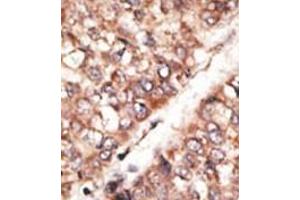 Image no. 1 for anti-Bone Morphogenetic Protein 3 (BMP3) (N-Term) antibody (ABIN357181) (BMP3 antibody  (N-Term))