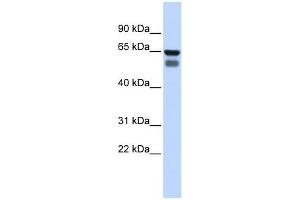 GALNT4 antibody used at 1 ug/ml to detect target protein.