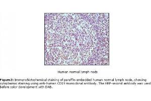 Image no. 1 for anti-CD19 Molecule (CD19) antibody (ABIN207604) (CD19 antibody)