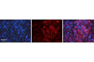 Rabbit Anti-ID2 Antibody   Formalin Fixed Paraffin Embedded Tissue: Human Liver Tissue Observed Staining: Cytoplasm Primary Antibody Concentration: 1:100 Other Working Concentrations: 1:600 Secondary Antibody: Donkey anti-Rabbit-Cy3 Secondary Antibody Concentration: 1:200 Magnification: 20X Exposure Time: 0.