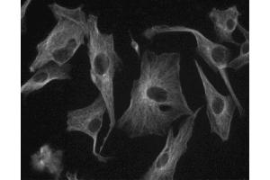 Immunofluorescent staining of U-87 MG (ATCC HTB-14) cells. (TUBB antibody)