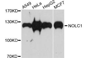 Western blot analysis of extracts of various cells, using NOLC1 antibody. (NOLC1 antibody)