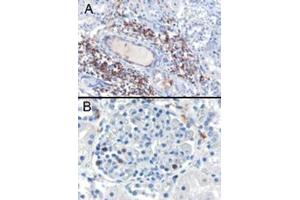 Image no. 1 for anti-SH3-Domain Binding Protein 1 (SH3BP1) (C-Term) antibody (ABIN374404) (SH3BP1 antibody  (C-Term))