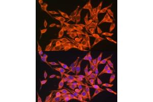 Immunofluorescence analysis of HeLa cells using MT- antibody (ABIN7268594) at dilution of 1:100. (Mitochondrially Encoded ATP Synthase 8 (MT-ATP8) antibody)
