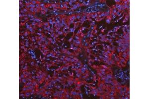 IF analysis of Cytokeratin 19 using anti-Cytokeratin 19 antibody (ABIN3043288). (Cytokeratin 19 antibody  (C-Term))