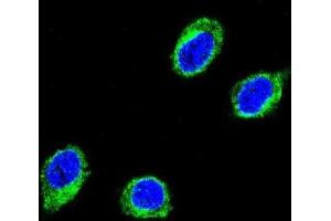 Immunofluorescence (IF) image for anti-Coiled-Coil alpha-Helical Rod Protein 1 (CCHCR1) antibody (ABIN3003788) (CCHCR1 antibody)
