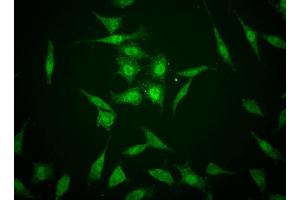 Immunofluorescent staining of human cell lines. (TAZ antibody)