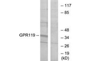 Western blot analysis of extracts from K562 cells, using GPR119 Antibody.