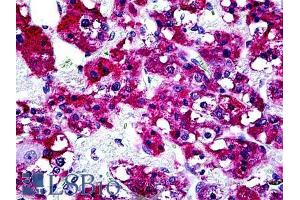 ABIN6391380 (3. (PTPN22 antibody  (Internal Region))